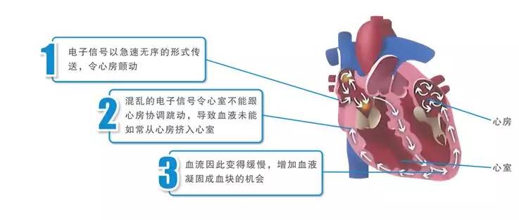 mapreduce心跳机制_检查心跳健康